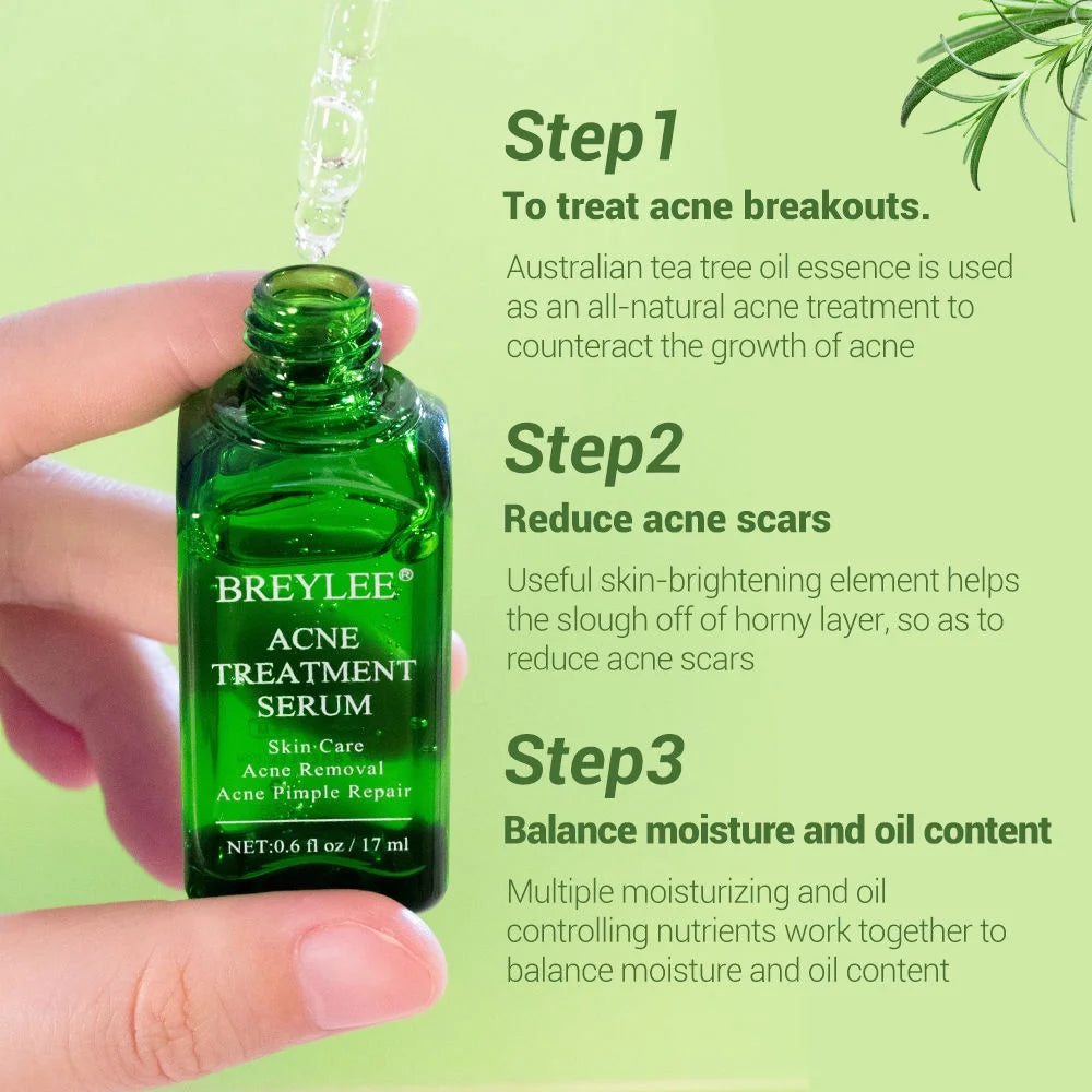 BREYLEE Acne Treatment Serum Facial Essence Liquid Shrink Pores   Acne Removal Repair Serum17ml